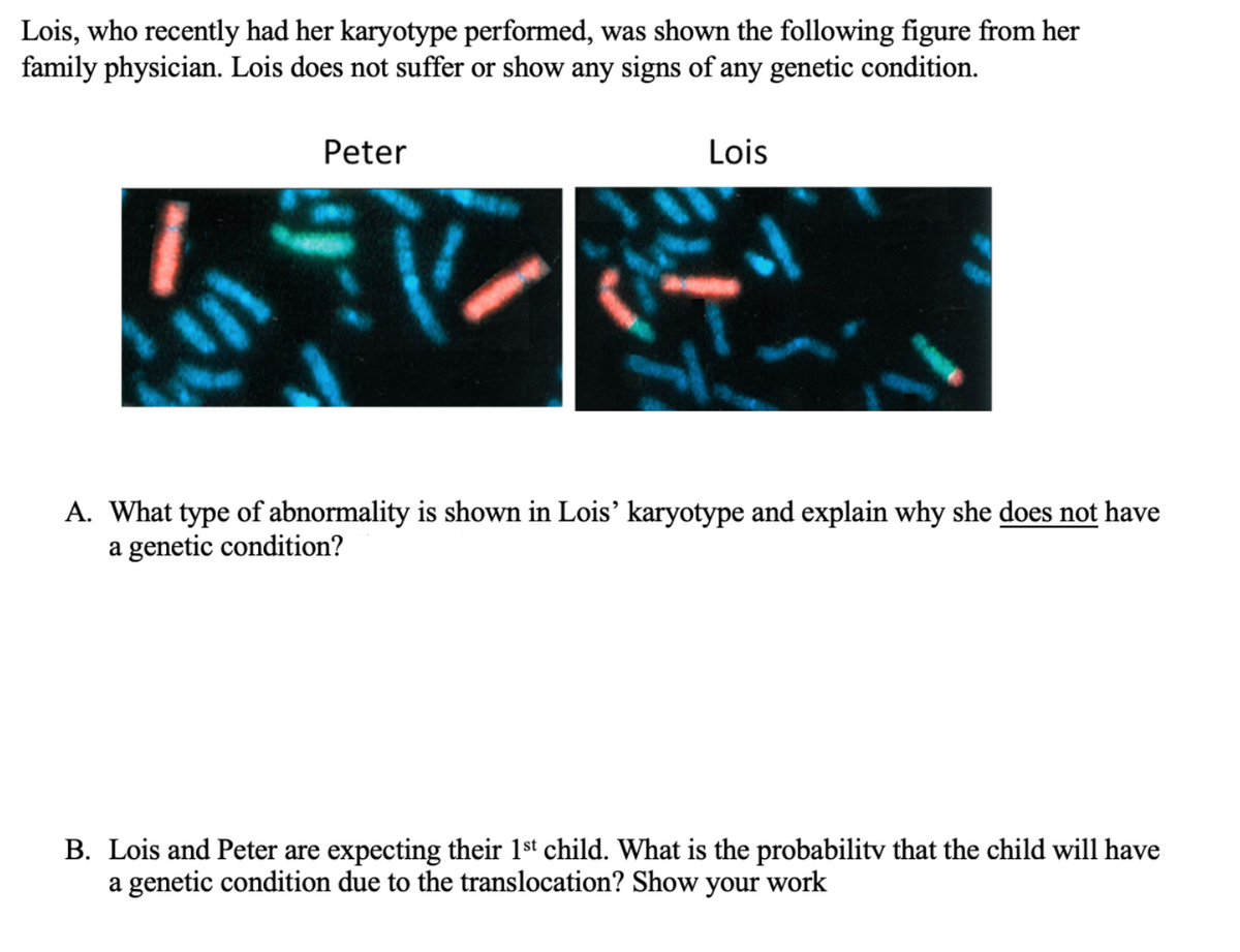Lois, who recently had her karyotype performed, was shown the following figure from her
family physician. Lois does not suffer or show any signs of any genetic condition.
Peter
Lois
A. What type of abnormality is shown in Lois' karyotype and explain why she does not have
a genetic condition?
B. Lois and Peter are expecting their 1st child. What is the probabilitv that the child will have
a genetic condition due to the translocation? Show your work
