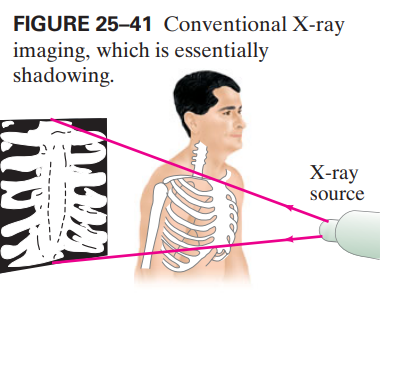 FIGURE 25–41 Conventional X-ray
imaging, which is essentially
shadowing.
Х-гay
source
