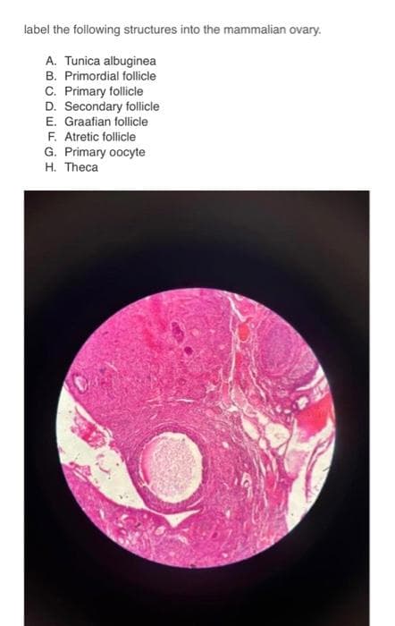 label the following structures into the mammalian ovary.
A. Tunica albuginea
B. Primordial follicle
C. Primary follicle
D. Secondary follicle
E. Graafian follicle
F. Atretic follicle
G. Primary oocyte
H. Theca