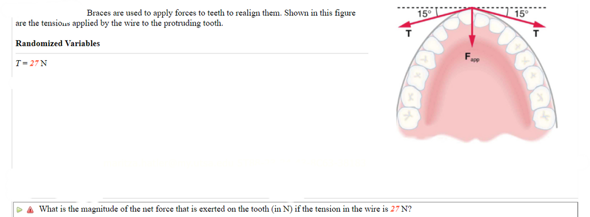 Braces are used to apply forces to teeth to realign them. Shown in this figure
are the tensions applied by the wire to the protruding tooth.
Randomized Variables
T = 27 N
▷ A What is the magnitude of the net force that is exerted on the tooth (in N) if the tension in the wire is 27 N?
15°
F app
15°