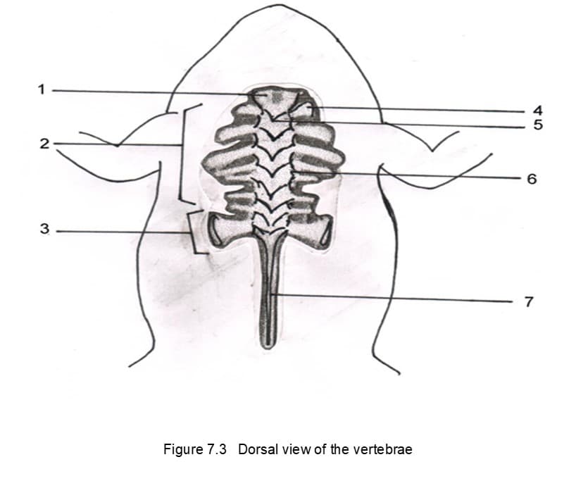 1
4
5
3
Figure 7.3 Dorsal view of the vertebrae
