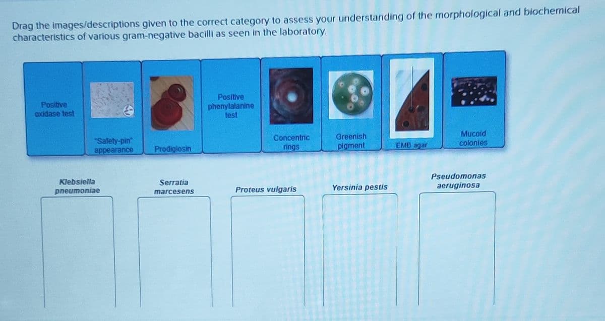 Drag the images/descriptions given to the correct category to assess your understanding of the morphological and biochemical
characteristics of various gram-negative bacilli as seen in the laboratory.
Positive
oxidase test
"Safety-pin"
appearance
Klebsiella
pneumoniae
Prodigiosin
Serratia
marcesens
Positive
phenylalanine
test
Concentric
rings
Proteus vulgaris
Greenish
pigment
Yersinia pestis
EMB agar
Mucoid
colonies
Pseudomonas
aeruginosa