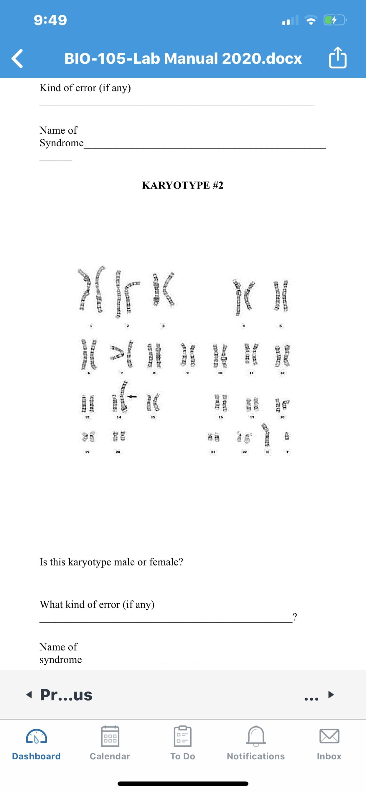 Is this karyotype male or female?
What kind of error (if any)
Name of
syndrome
