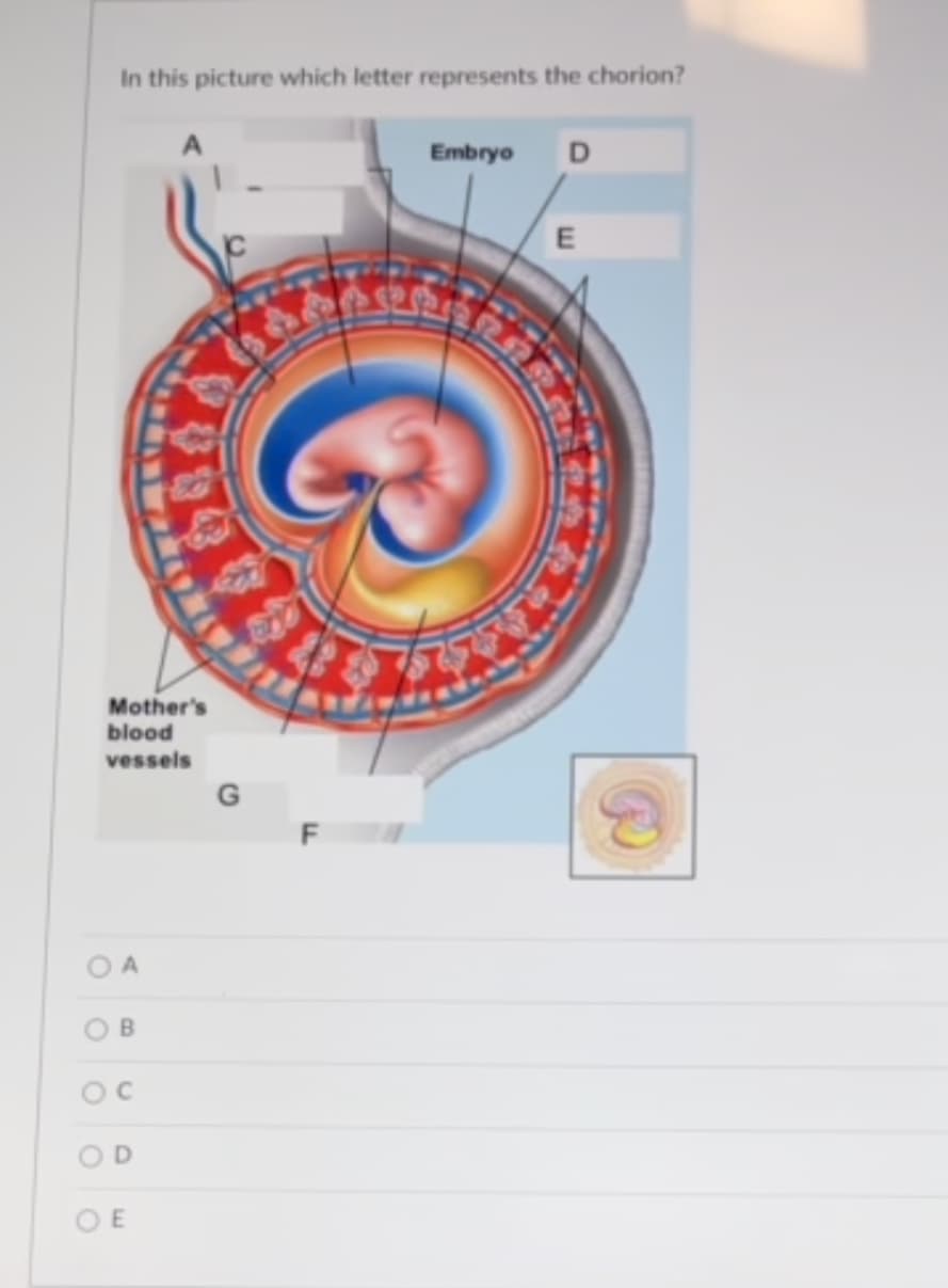 In this picture which letter represents the chorion?
Embryo
Mother's
blood
vessels
O A
OB
OD
O E
