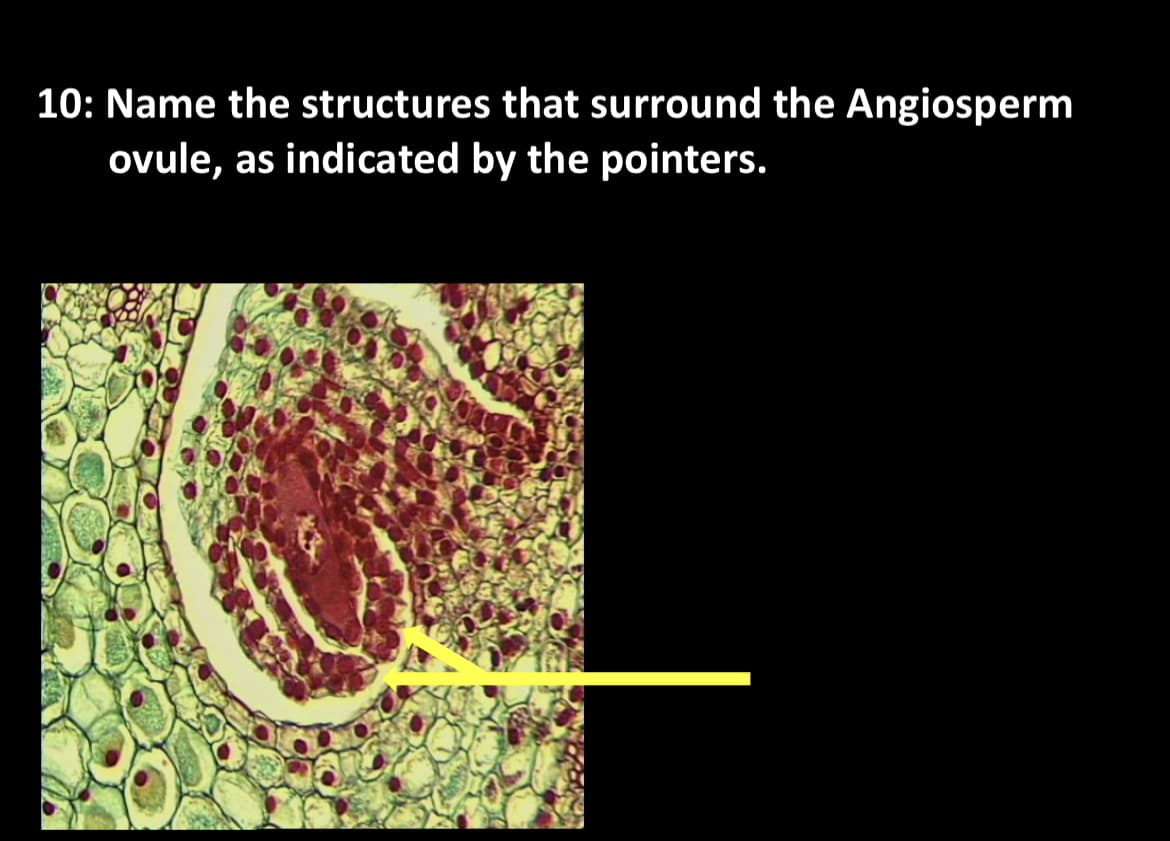 10: Name the structures that surround the Angiosperm
ovule, as indicated by the pointers.
