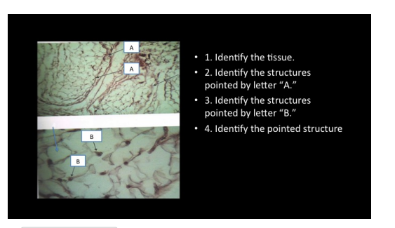 A
• 1. Identify the tissue.
• 2. Identify the structures
A
pointed by letter "A."
• 3. Identify the structures
pointed by letter “B."
• 4. Identify the pointed structure
