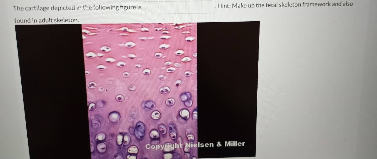 The cartilage depicted in the following figure is
.Hint: Make up the fetal skeleton framework and also
found in adult skeleton.
Copyright Nielsen & Miller
