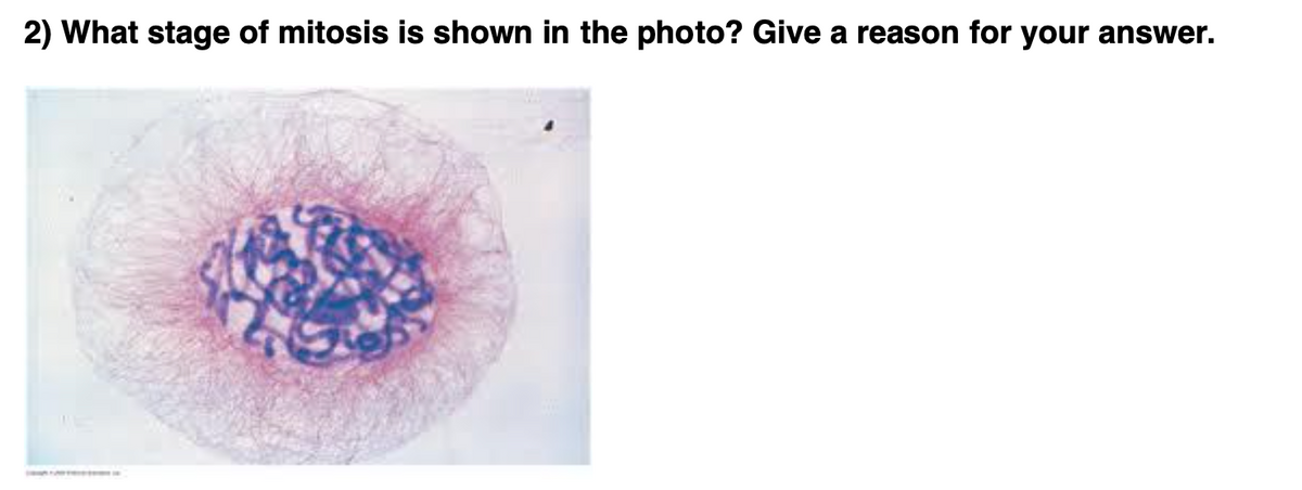 2) What stage of mitosis is shown in the photo? Give a reason for your answer.
