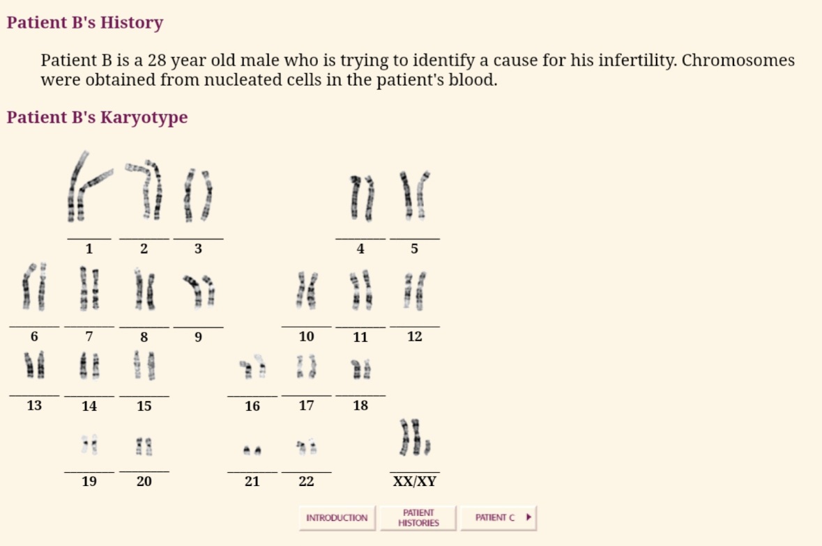 Patient B's History
Patient B is a 28 year old male who is trying to identify a cause for his infertility. Chromosomes
were obtained from nucleated cells in the patient's blood.
Patient B's Karyotype
1
5
7
8
10
11
12
13
14
15
16
17
18
%3B
19
20
21
22
XX/XY
PATIENT
HISTORIES
INTRODUCTION
PATIENT C
