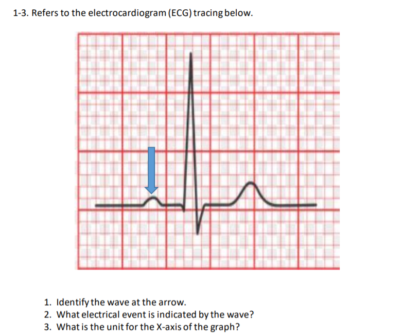1-3. Refers to the electrocardiogram (ECG) tracing below.
1. Identify the wave at the arrow.
2. What electrical event is indicated by the wave?
3. What is the unit for the X-axis of the graph?
