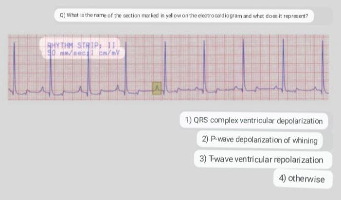 Q) What is the name of the section mar ked in yellow on the electrocardiogram and what does it represent?
RHYTHM STRIP, 11
50 mm/secl cm/my
1) QRS complex ventricular depolarization
2) P-wave depolarization of whining
3) T-wave ventricular repolarization
4) otherwise
