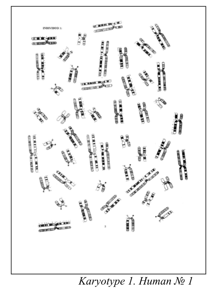 INDIVIDUO I:
Кaryotype 1. Hитап No 1
D
