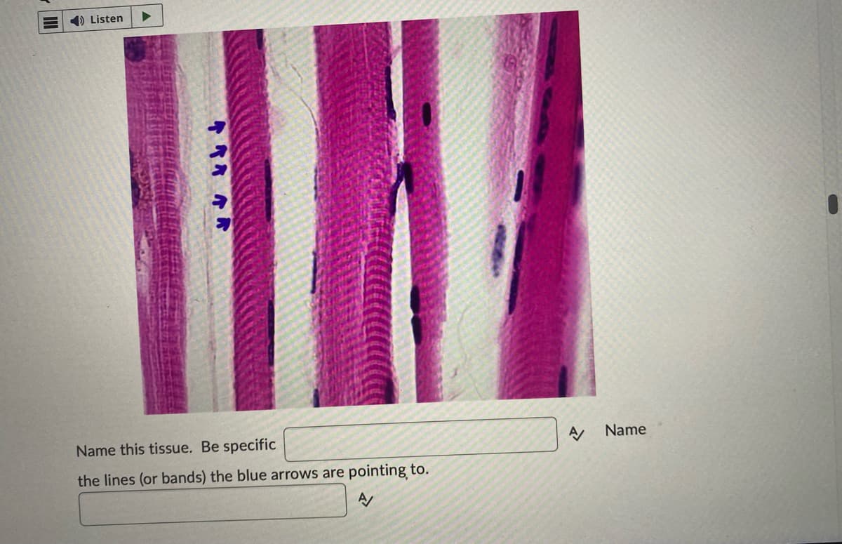 Listen
WIKI
Name this tissue. Be specific
the lines (or bands) the blue arrows are pointing to.
A/
A Name