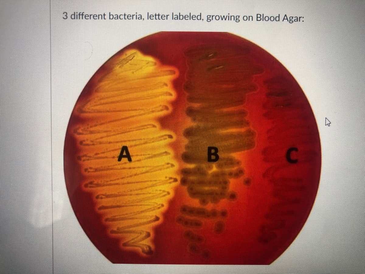 3 different bacteria, letter labeled, growing
on Blood Agar:
A
