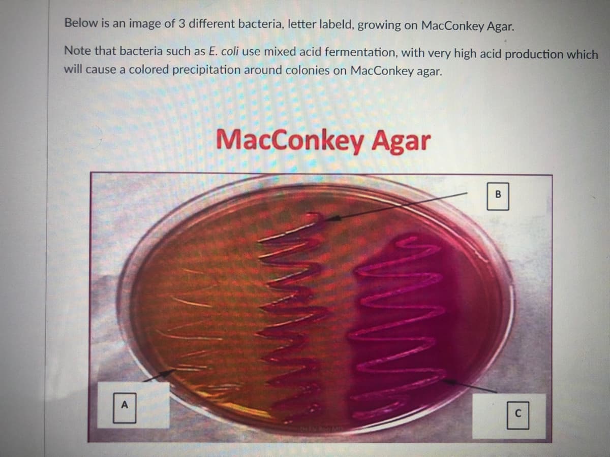 Below is an image of 3 different bacteria, letter labeld, growing on MacConkey Agar.
Note that bacteria such as E. coli use mixed acid fermentation, with very high acid production which
will cause a colored precipitation around colonies on MacConkey agar.
MacConkey Agar
C
