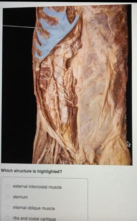 Which structure is highlighted?
O external intercostal muscle
O sternum
internal oblique muscle
O ribs and costal cartilage
