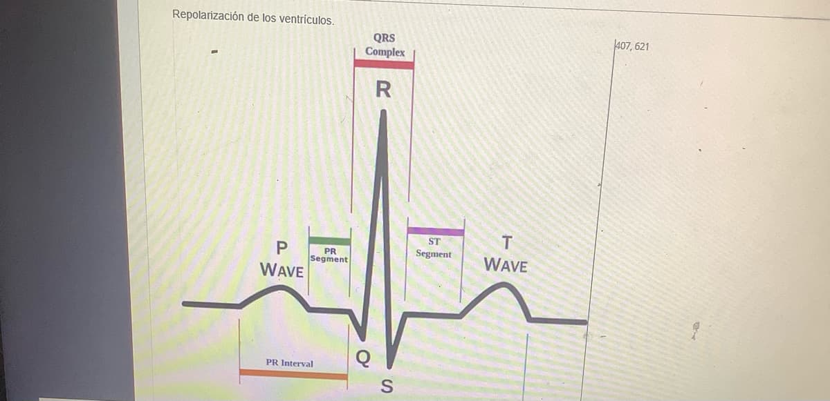 Repolarización de los ventrículos.
P
WAVE
PR
Segment
PR Interval
QRS
Complex
R
S
ST
Segment
T
WAVE
407, 621