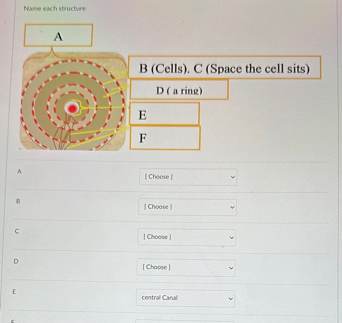 A
B
LL
C
D
E
Name each structure
A
B (Cells). C (Space the cell sits)
D (a ring)
E
F
[Choose ]
[Choose ]
[Choose ]
[Choose ]
central Canal