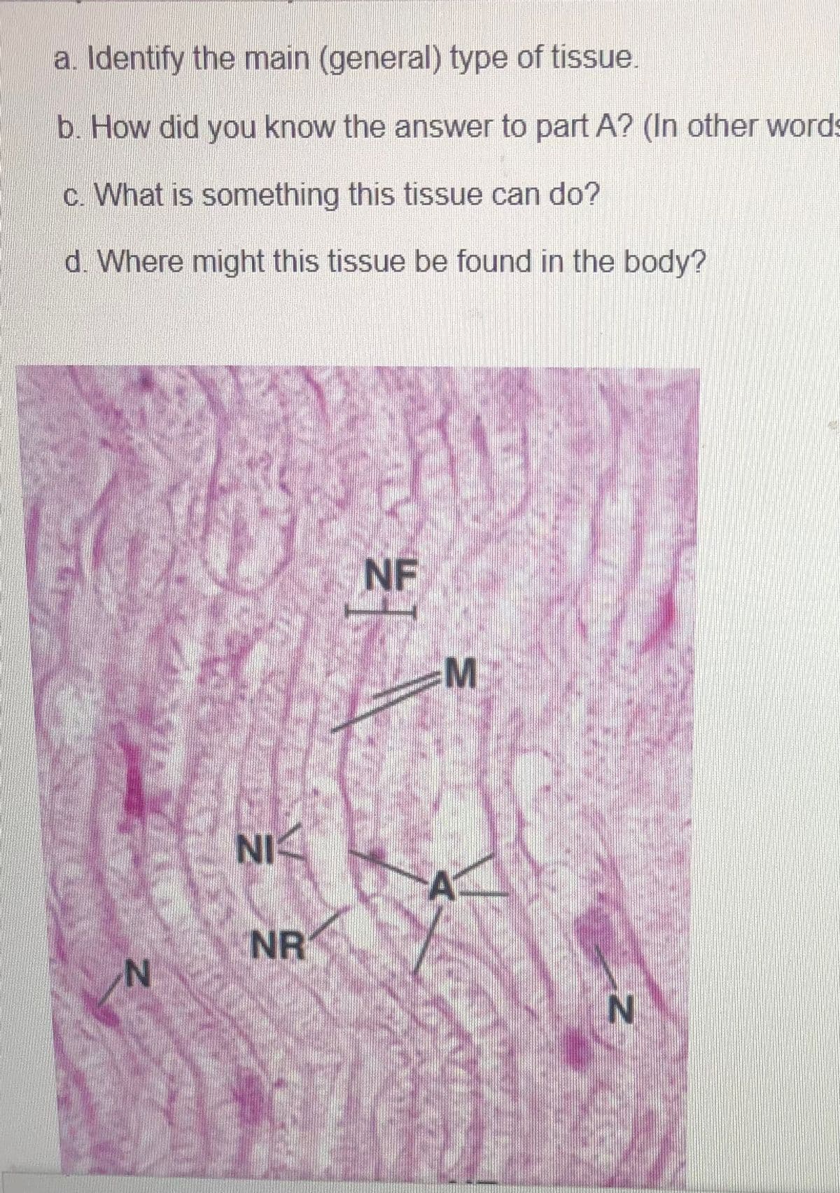 a. Identify the main (general) type of tissue.
b. How did you know the answer to part A? (In other words
c. What is something this tissue can do?
d. Where might this tissue be found in the body?
NF
M
NI
NR
N'
