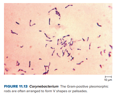 H
10 μη
FIGURE 11.13 Corynebacterium The Gram-positive pleomorphic
rods are often arranged to form V shapes or palisades.
