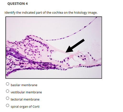 QUESTION 4
Identify the indicated part of the cochlea on the histology image.
O basilar membrane
vestibular membrane
tectorial membrane
spiral organ of Corti
