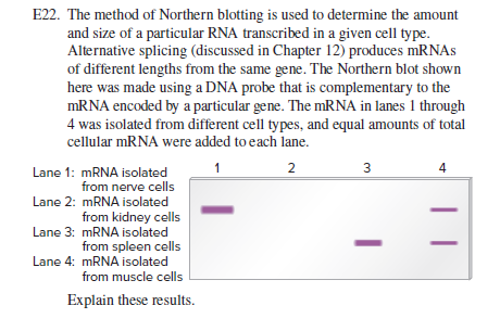 E22. The method of Northern blotting is used to determine the amount
and size of a particular RNA transcribed in a given cell type.
Alternative splicing (discussed in Chapter 12) produces mRNAs
of different lengths from the same gene. The Northern blot shown
here was made using a DNA probe that is complementary to the
MRNA encoded by a particular gene. The mRNA in lanes 1 through
4 was isolated from different cell types, and equal amounts of total
cellular MRNA were added to each lane.
2
3
4
Lane 1: MRNA isolated
from nerve cells
Lane 2: MRNA isolated
from kidney cells
Lane 3: MRNA isolated
from spleen cells
Lane 4: MRNA isolated
from muscle cells
Explain these results.
| |
