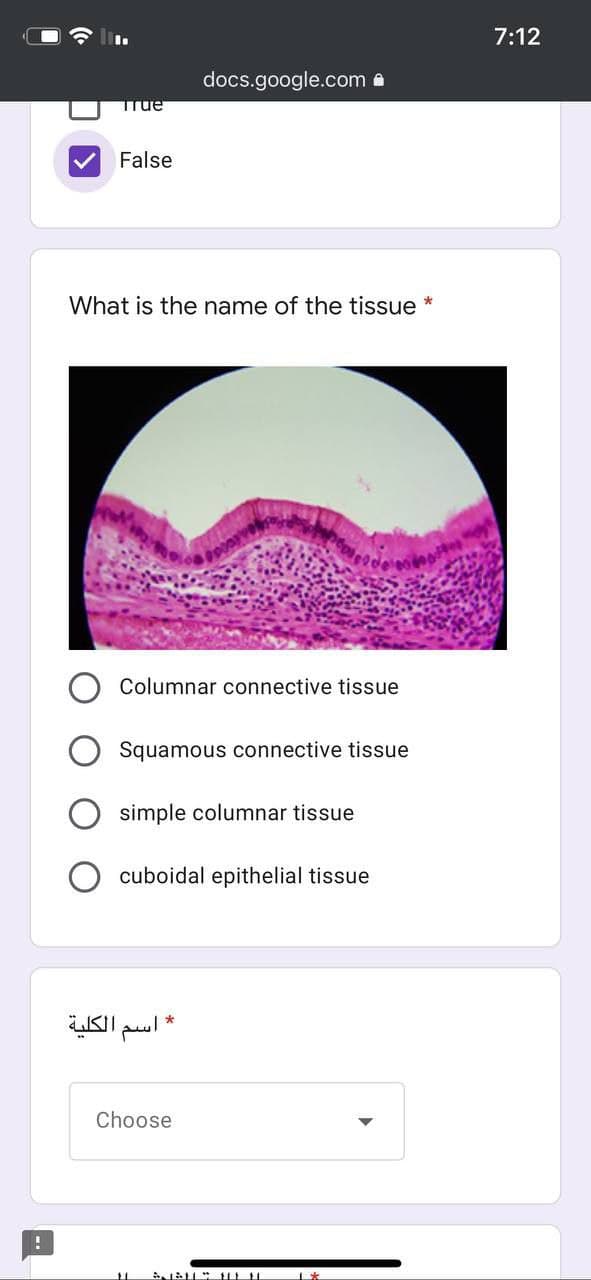 7:12
docs.google.com a
TTue
False
What is the name of the tissue
Columnar connective tissue
Squamous connective tissue
simple columnar tissue
cuboidal epithelial tissue
* اسم الكلية
Choose
