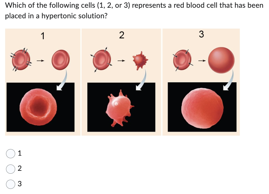 Which of the following cells (1, 2, or 3) represents a red blood cell that has been
placed in a hypertonic solution?
1
1
2
3
2
3