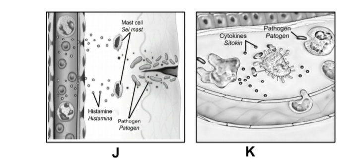 Mast cell
Sel mast
Pathogen
Patogen
Cytokines
Sitokin
Histamine
Histamina Pathogen
Patogen
J
K
