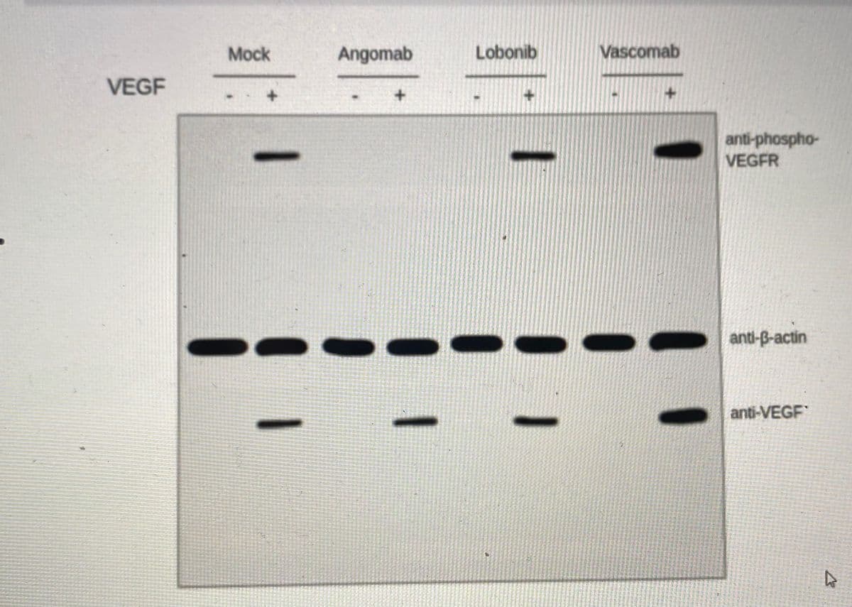 Mock
Angomab
Lobonib
Vascomab
VEGF
anti-phospho-
VEGFR
|
anti-B-actin
anti-VEGF
