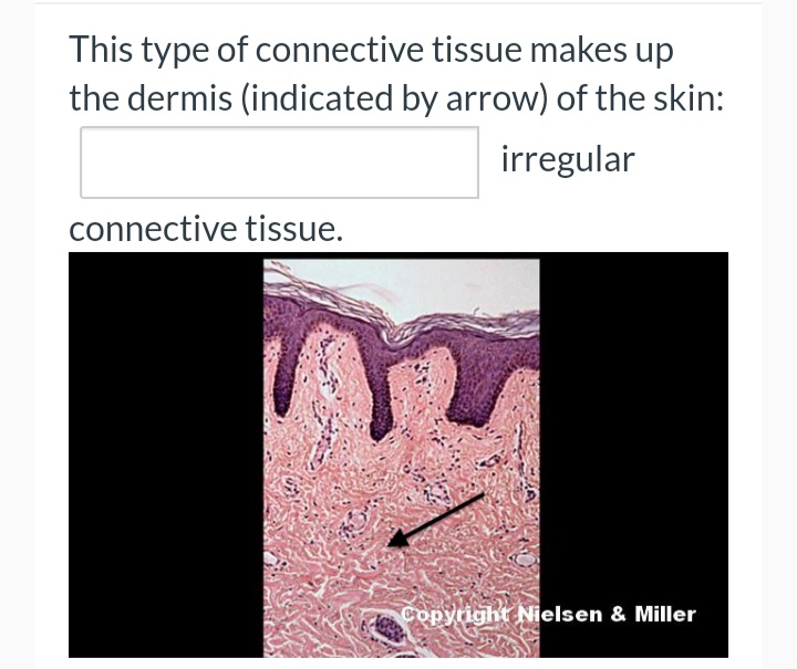 This type of connective tissue makes up
the dermis (indicated by arrow) of the skin:
irregular
connective tissue.
Copyright Nielsen & Miller
