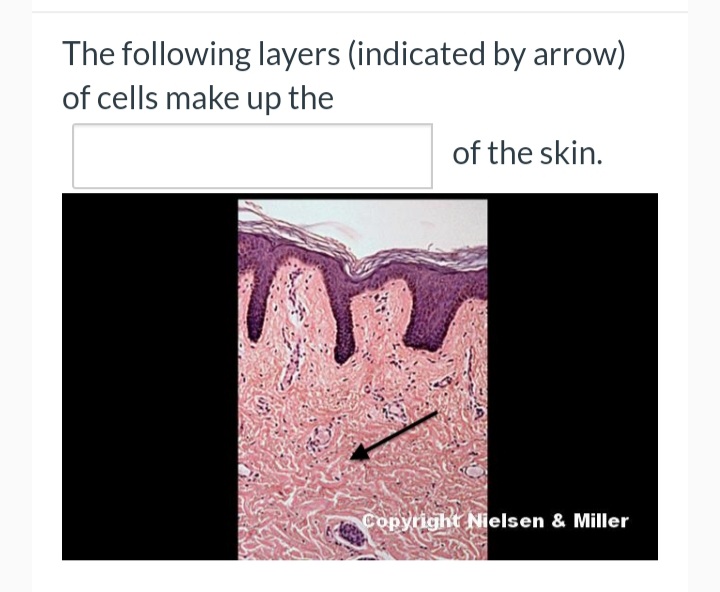 The following layers (indicated by arrow)
of cells make up the
of the skin.
Copyright Nielsen & Miller

