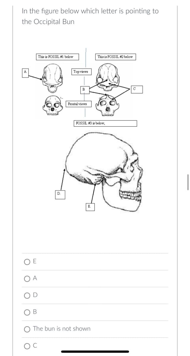 In the figure below which letter is pointing to
the Occipital Bun
O E
O A
D
OB
This is FOSSIL #1 below
C
bocora
D
Top views
B
Frontal views
The bun is not shown
This is FOSSIL #2 below
wobokoch
FOSSIL #3 is below,