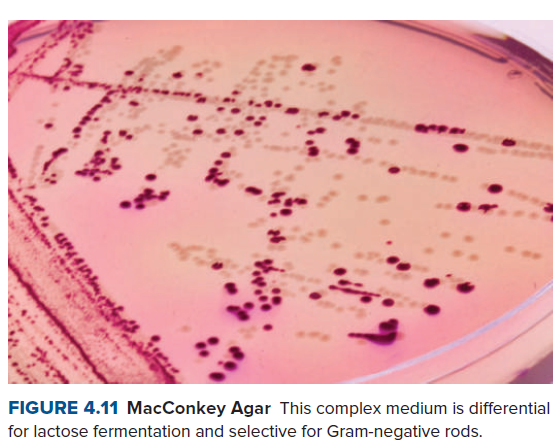 FIGURE 4.11 MacConkey Agar This complex medium is differential
for lactose fermentation and selective for Gram-negative rods.
