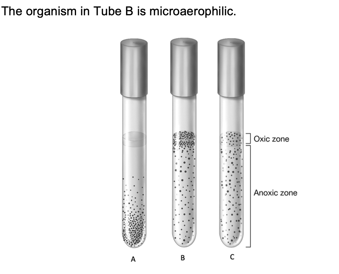 The organism in Tube B is microaerophilic.
Oxic zone
Anoxic zone
А
В
C
