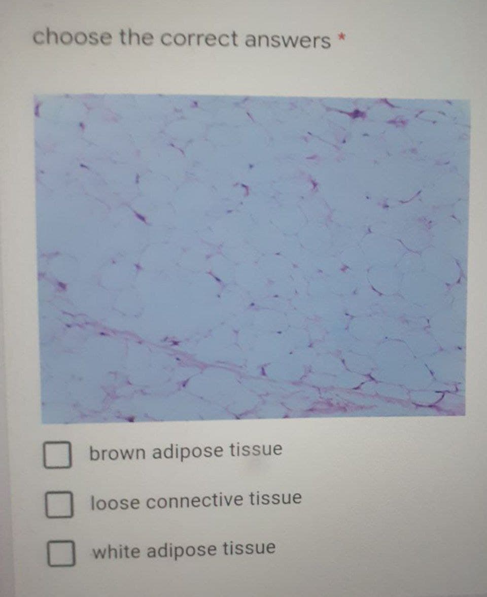 choose the correct answers
brown adipose tissue
loose connective tissue
white adipose tissue
