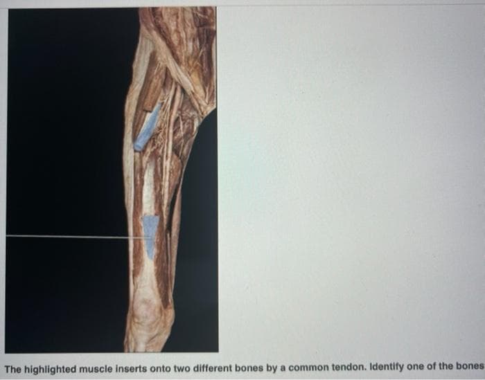 The highlighted muscle inserts onto two different bones by a common tendon. Identify one of the bones
