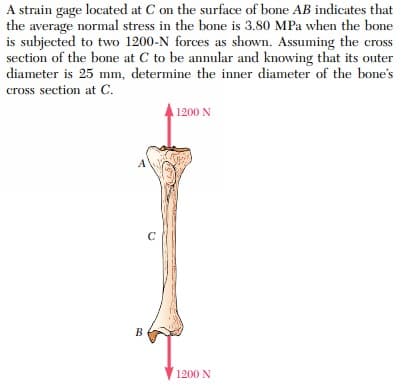 A strain gage located at C on the surface of bone AB indicates that
the average normal stress in the bone is 3.80 MPa when the bone
is subjected to two 1200-N forces as shown. Assuming the cross
section of the bone at C to be annular and knowing that its outer
diameter is 25 mm, determine the inner diameter of the bone's
cross section at C.
1200 N
C
B
1200 N
