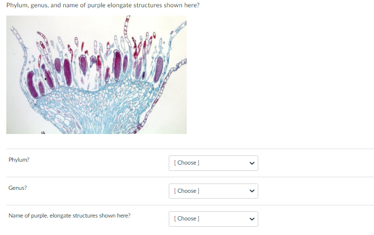Phylum, genus, and name of purple elongate structures shown here?
Phylum?
Genus?
Name of purple, elongate structures shown here?
[Choose]
[Choose ]
[Choose ]