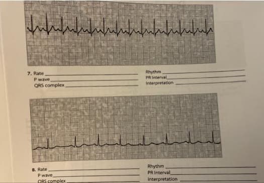 Infufufufu/nufnufnufufuka
7. Rate
P wave,
QRS complex,
8. Rate
P wave,
ORS complex
ملسيلت
Rhythm
PR Interval
Interpretation
Rhythm
PR Interval
Interpretation