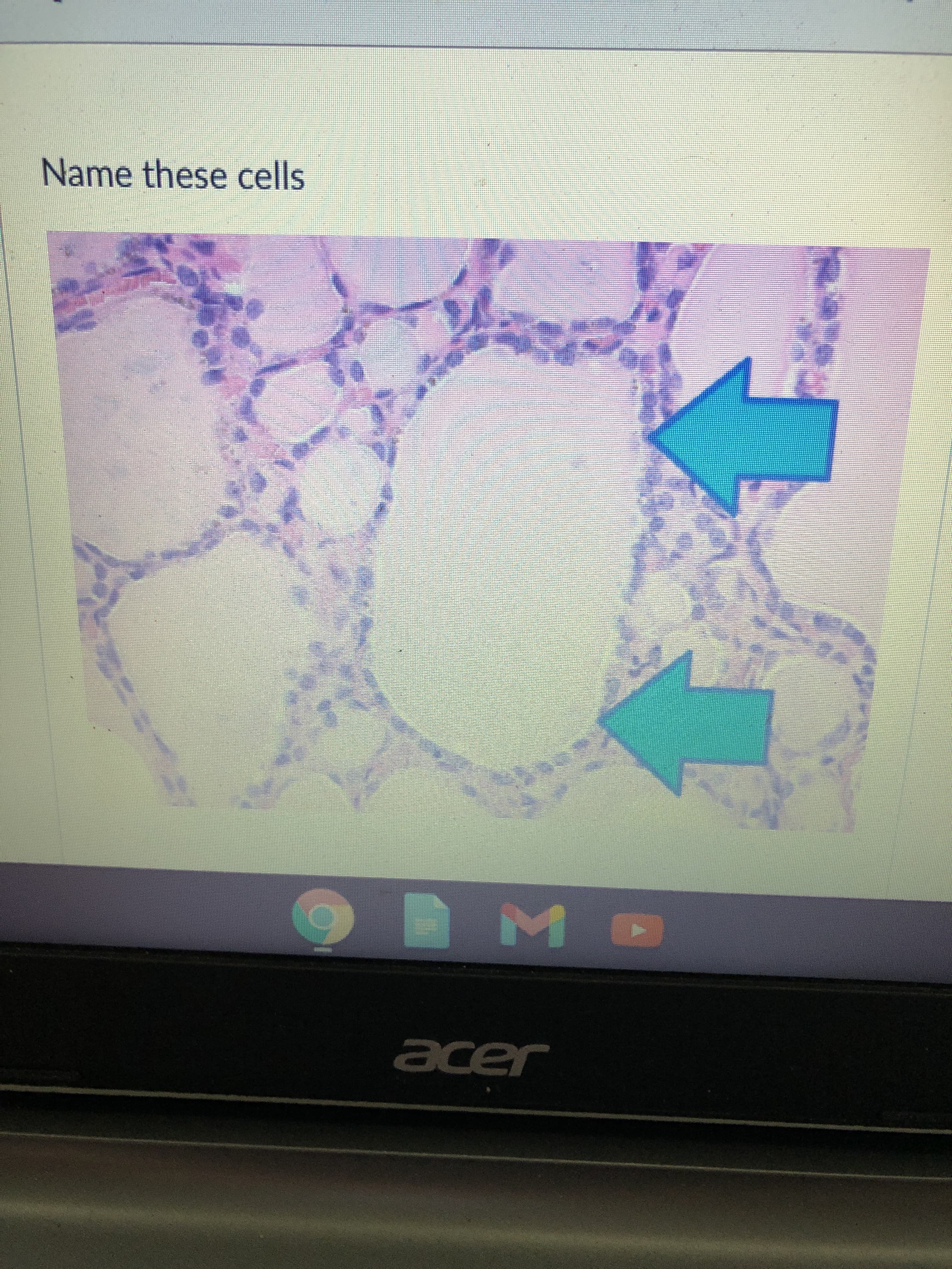 Name these cells

