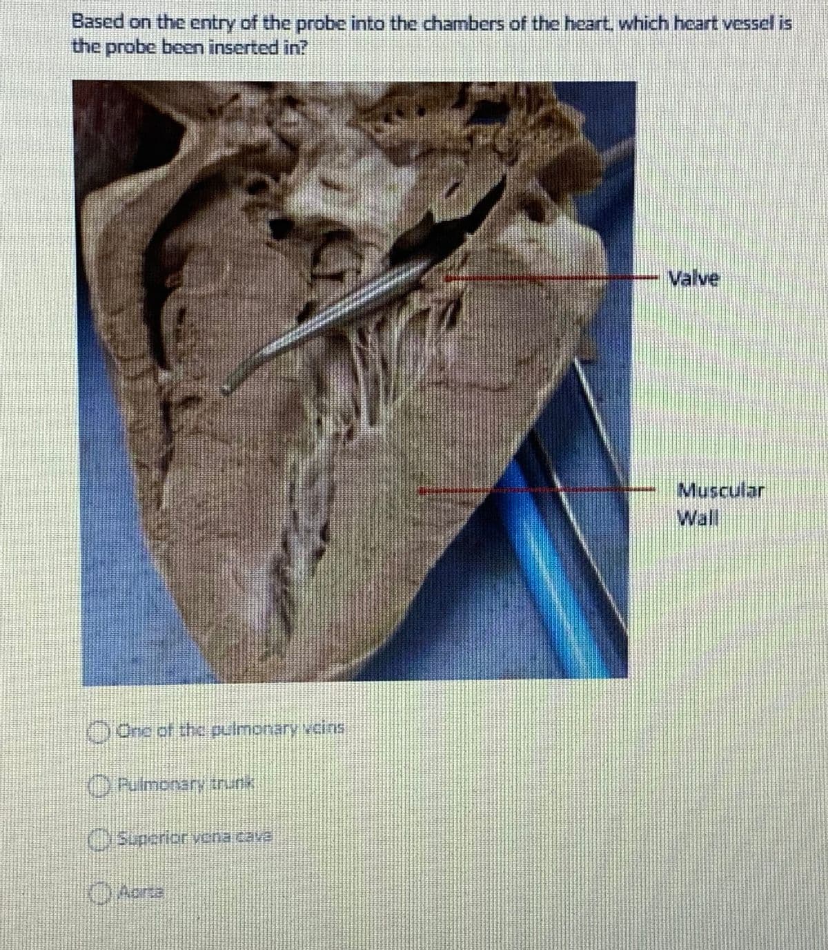 Based on the entry of the probe into the chambers of the heart, which heart vessel is
the probe been inserted in?
Valve
Muscular
Wall
0One of the pulmonary vens
ORmonary trnk
OSpcriorvena (avë
