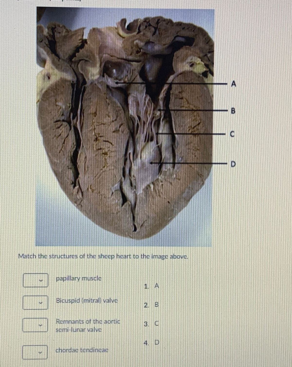 Match the structures of the sheep heart to the image above.
papillary muscle
1 A
Bicuspid (mitral) valve
2. B
Remnants of the aortic
semi lunar valve
3. C
4. D
chordac tendincac
B.
