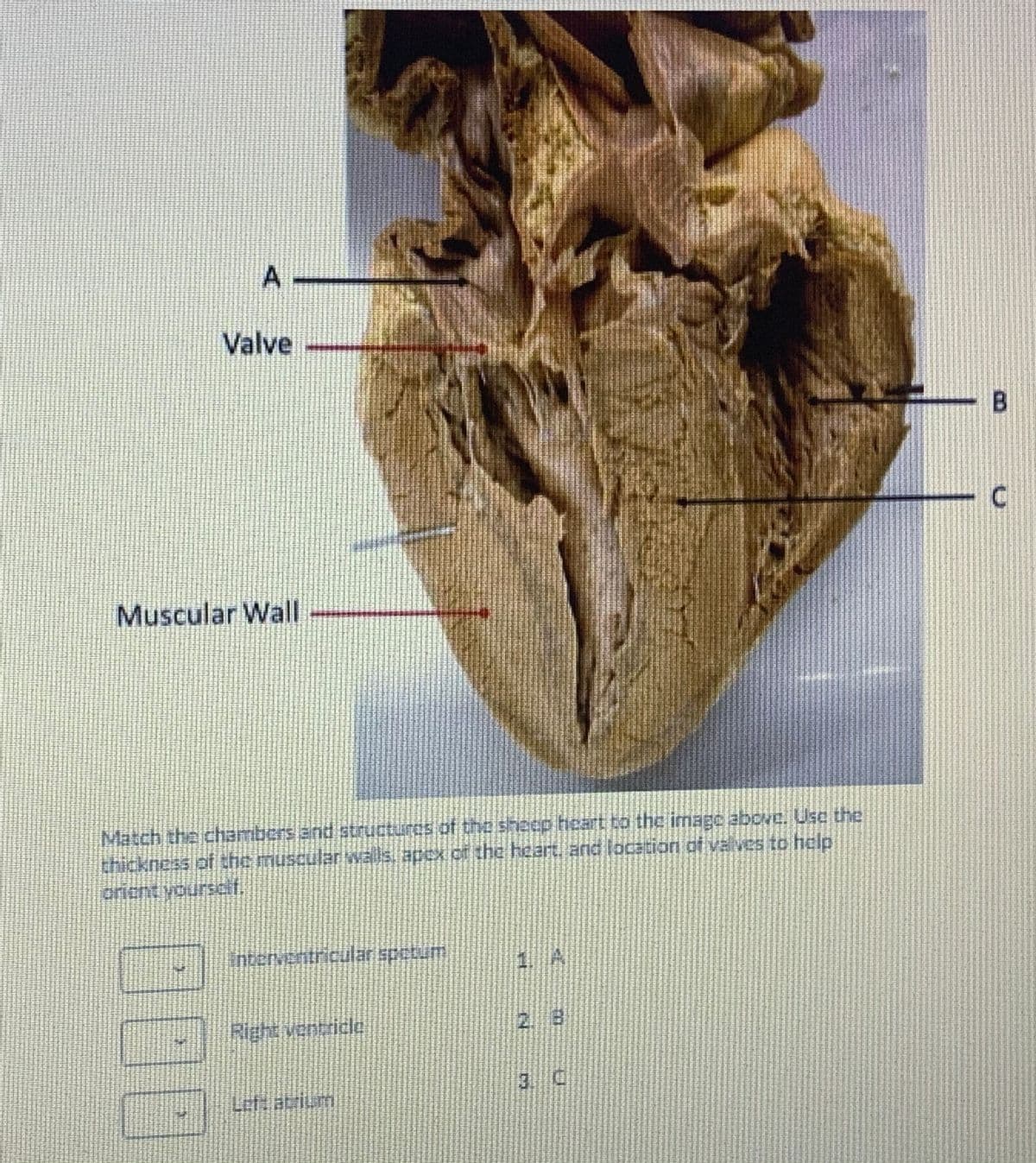 Valve
Muscular Wall
Mätch the chamibers and structures of the sheep heart to the image abovc. Use the
thickness pf the muscular walls. apEx Of the heart, and location of valves to help
crient yourscf.
interventricuülar spctum
Right vencricle
2 8
3. C

