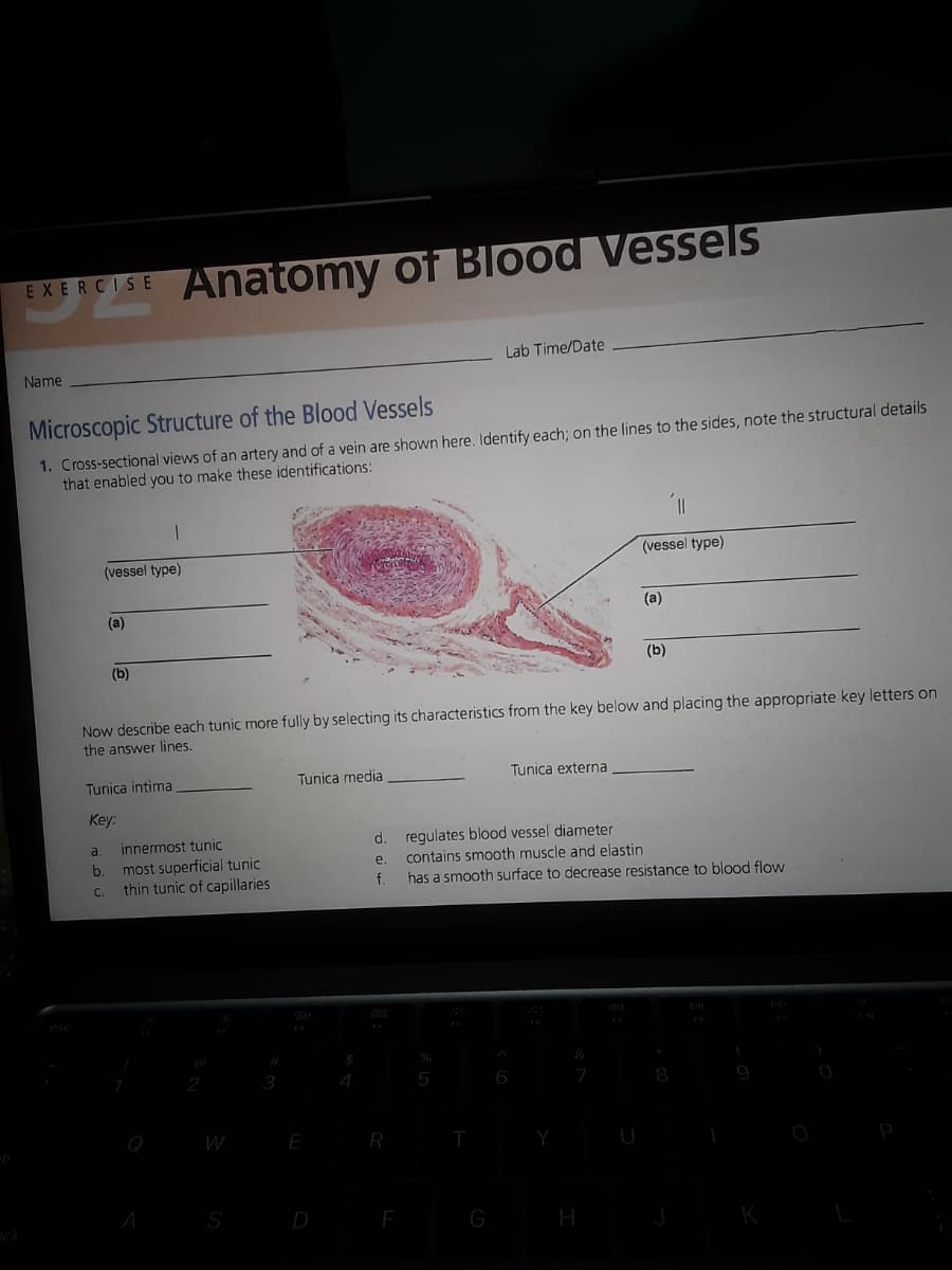 EXERCISE Anatomy of Blood Vessels
Lab Time/Date
Name
Microscopic Structure of the Blood Vessels
1. Cross-sectional views of an artery and of a vein are shown here. Identify each; on the lines to the sides, note the structural details
that enabled you to make these identifications:
1
(vessel type)
(vessel type)
(a)
(a)
(b)
(b)
Now describe each tunic more fully by selecting its characteristics from the key below and placing the appropriate key letters on
the answer lines.
Tunica externa
Tunica media
Tunica intima
Key:
a.
d.
regulates blood vessel diameter
b.
e contains smooth muscle and elastin
C.
f. has a smooth surface to decrease resistance to blood flow
&
4
8
J
innermost tunic
most superficial tunic
thin tunic of capillaries
3
A
W
S
E
D
R
F
T
G
Y
H