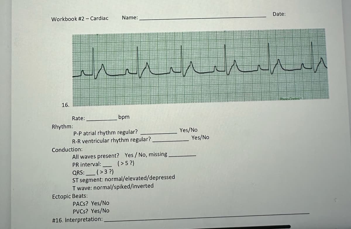 Workbook #2 - Cardiac
16.
حيد
Rate:
bpm
P-P atrial rhythm regular?
R-R ventricular rhythm regular?.
Rhythm:
Conduction:
All waves present? Yes / No, missing.
PR interval:
(>5?)
Name:
QRS: (>3?)
ST segment: normal/elevated/depressed
T wave: normal/spiked/inverted
Ectopic Beats:
PACS? Yes/No
PVCs? Yes/No
# 16. Interpretation:
مددسرا
اش
Yes/No
Date:
Yes/No
Physio-Control