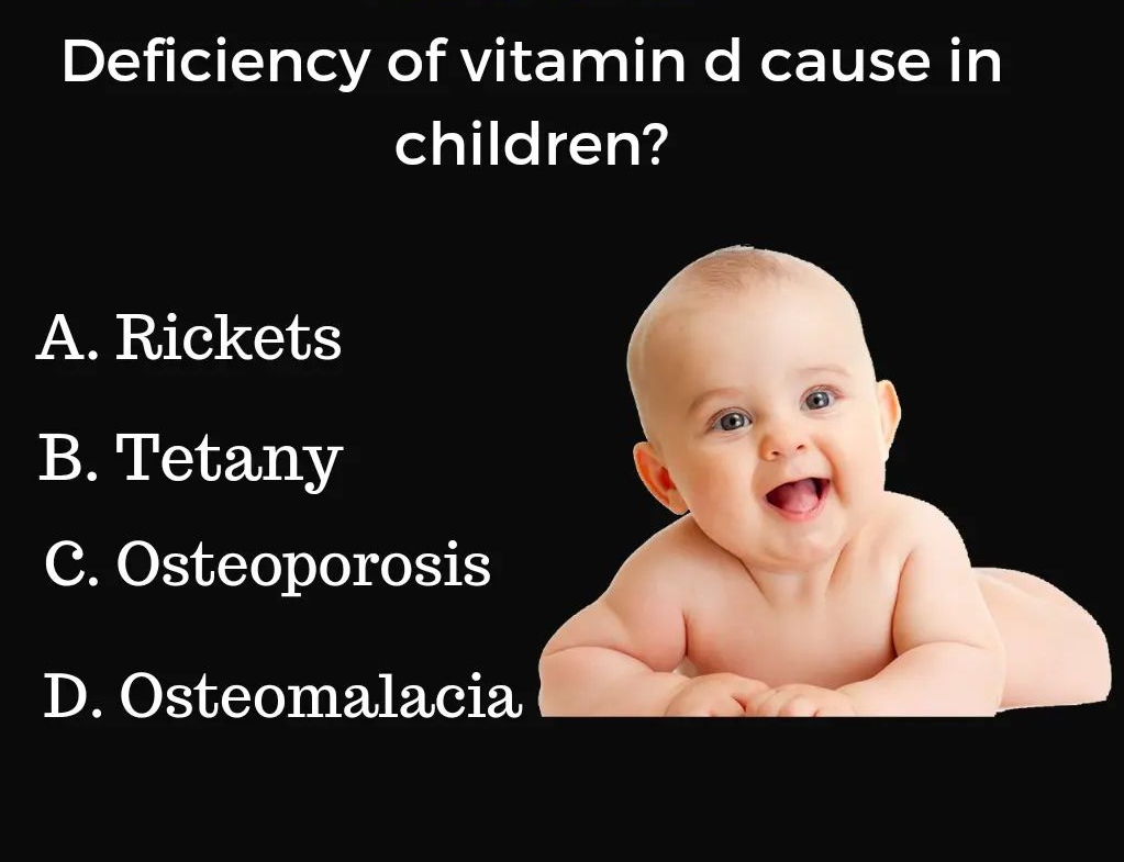 Deficiency of vitamin d cause in
children?
A. Rickets
B. Tetany
C. Osteoporosis
D. Osteomalacia