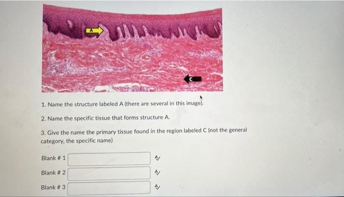 1. Name the structure labeled A (there are several in this image).
2. Name the specific tissue that forms structure A.
3. Give the name the primary tissue found in the region labeled C (not the general
category, the specific name)
Blank # 1
Blank # 2
Blank # 3
