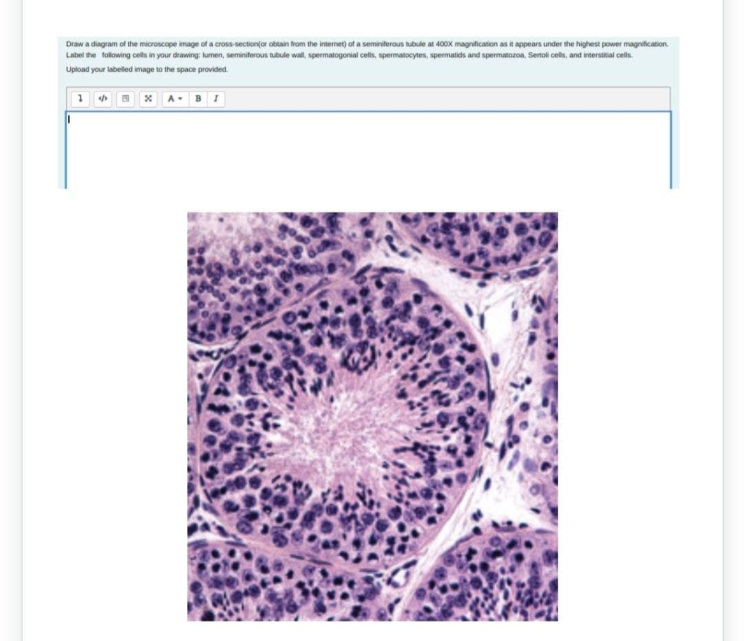 Draw a diagram of the microscope image of a cross-section (or obtain from the internet) of a seminiferous tubule at 400X magnification as it appears under the highest power magnification.
Label the following cells in your drawing: lumen, seminiferous tubule wall, spermatogonial cells, spermatocytes, spermatids and spermatozoa, Sertoli cells, and interstitial cells.
Upload your labelled image to the space provided.
I
1
</
x
A-
B I