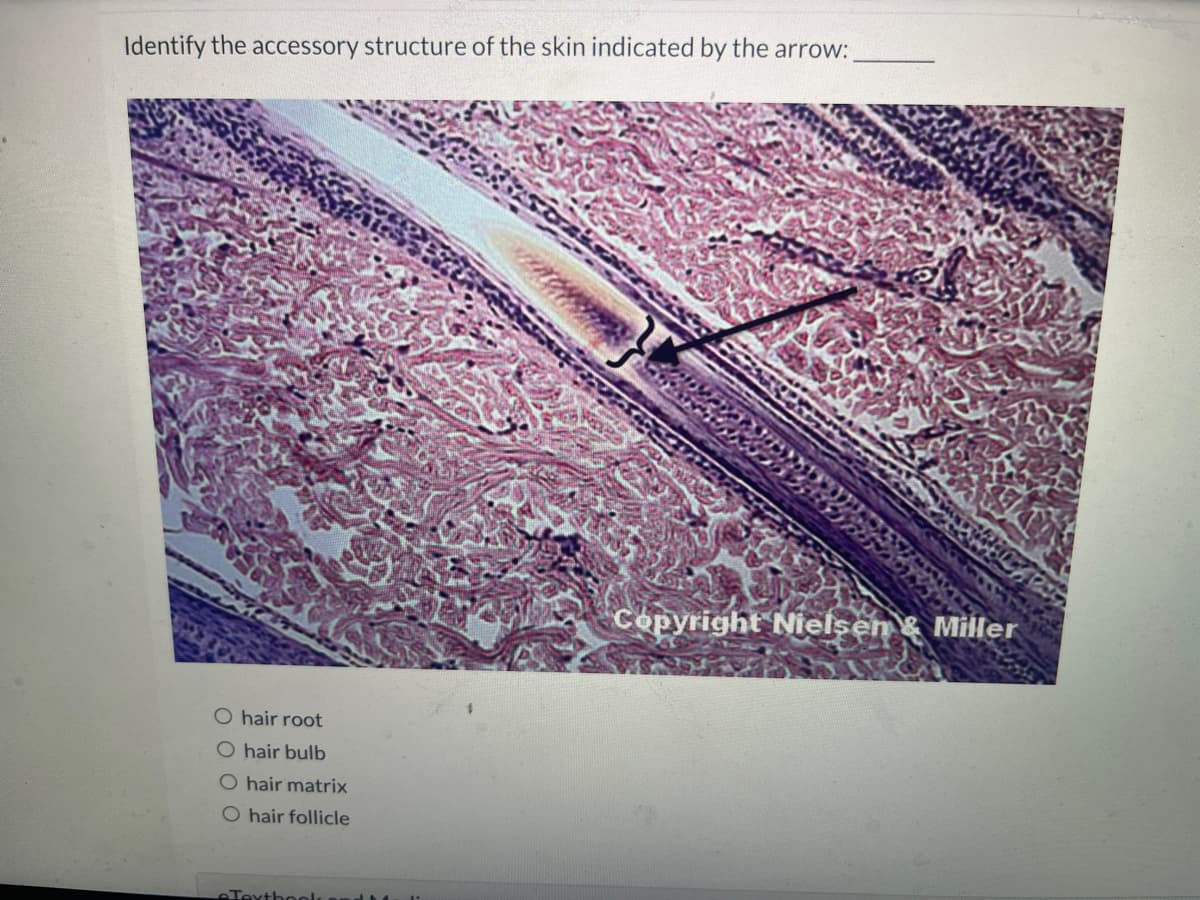 Identify the accessory structure of the skin indicated by the arrow:
O hair root
O hair bulb
O hair matrix
O hair follicle
Textbook
Copyright Nielsen & Miller